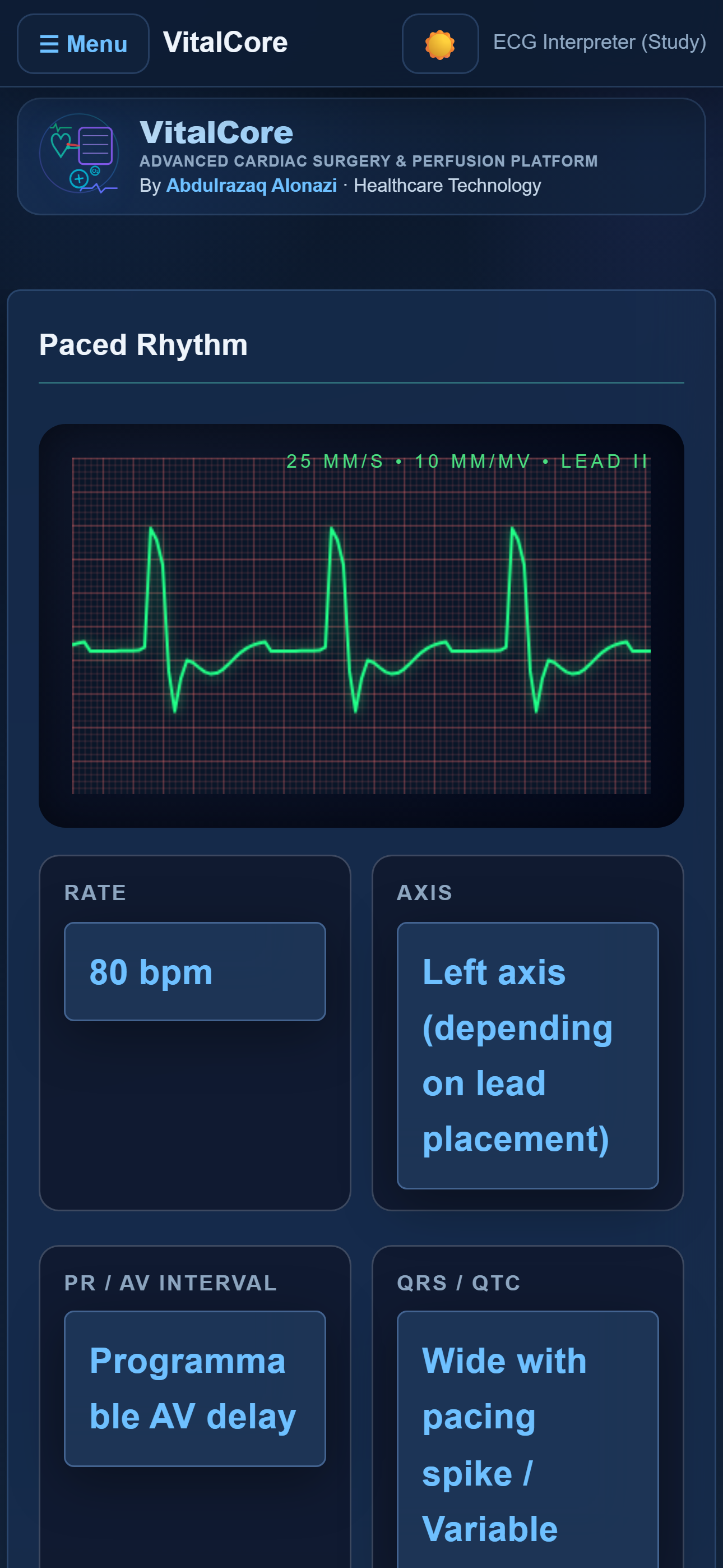 ECG pattern study and analyzer